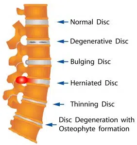 Illustration of spine cord
