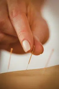 close up view of a acupuncture needle for acupuncture treatment in aurora