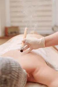 Acupuncture treatment in Aurora